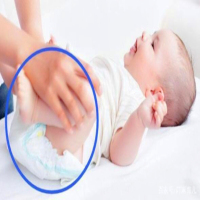 Avoid the wrong action of changing the baby's diapers（1）